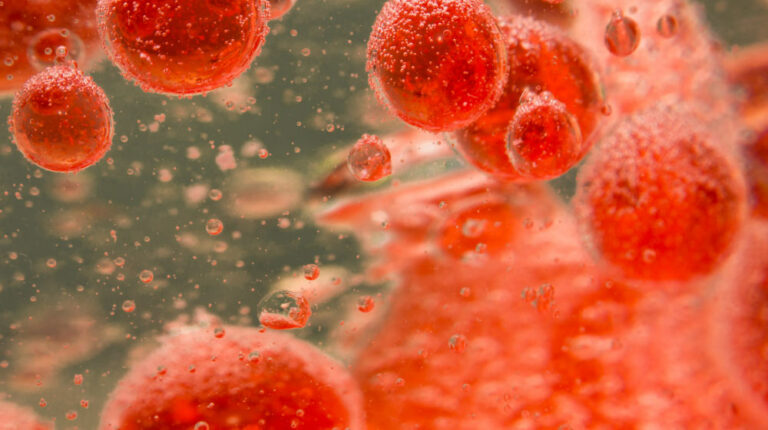 Red-blood-cells-Too-Much-Iron-in-Blood-Can-Be-Life-threatening