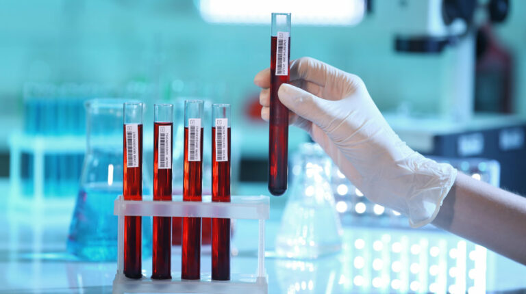 the-test-tube-in-the-blood-test-Inflammatory-Markers-in-Blood-Why-They-Are-Your-Silent-Threats